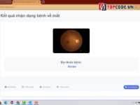 Code đồ án - Ứng dụng một số kĩ thuật Deep Learning Nhận Biết Bệnh Về Mắt + File báo cáo - Code Python - Visual Studio Code