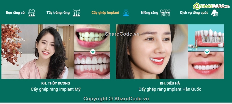 Sharecode website nha khoa,nha khoa,full code nha khoa,website nha khoa,code nha khoa,chothemewp