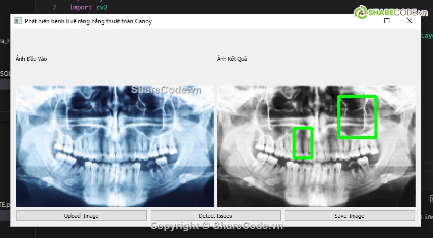 xử lí ảnh,python,xử lí ảnh python,phát hiện,xử lí ảnh thuật toán